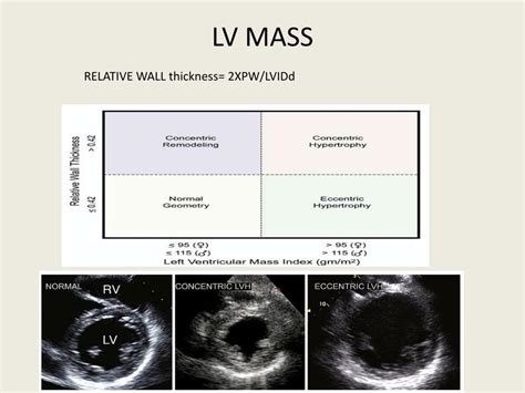 lv mass csecho|normal Lv mass echo.